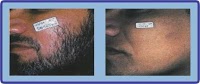 Epilight New Skin Clinic 380616 Image 5